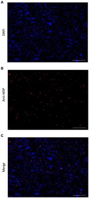 Improved metagenome assemblies through selective enrichment of bacterial genomic DNA from eukaryotic host genomic DNA using ATAC-seq